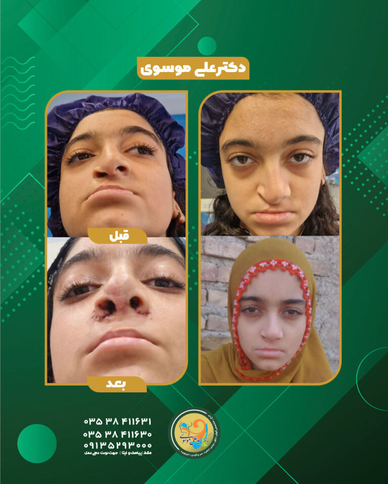 سیزده سال تلاش برای یک لبخند کامل