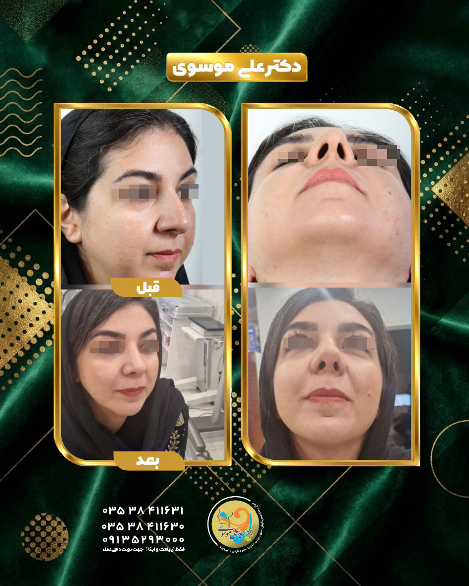 جراحی زیبایی یزد 