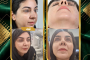 جراحی زیبایی بینی یزد | عمل بینی فوق‌العاده طبیعی به درخواست زیباجو