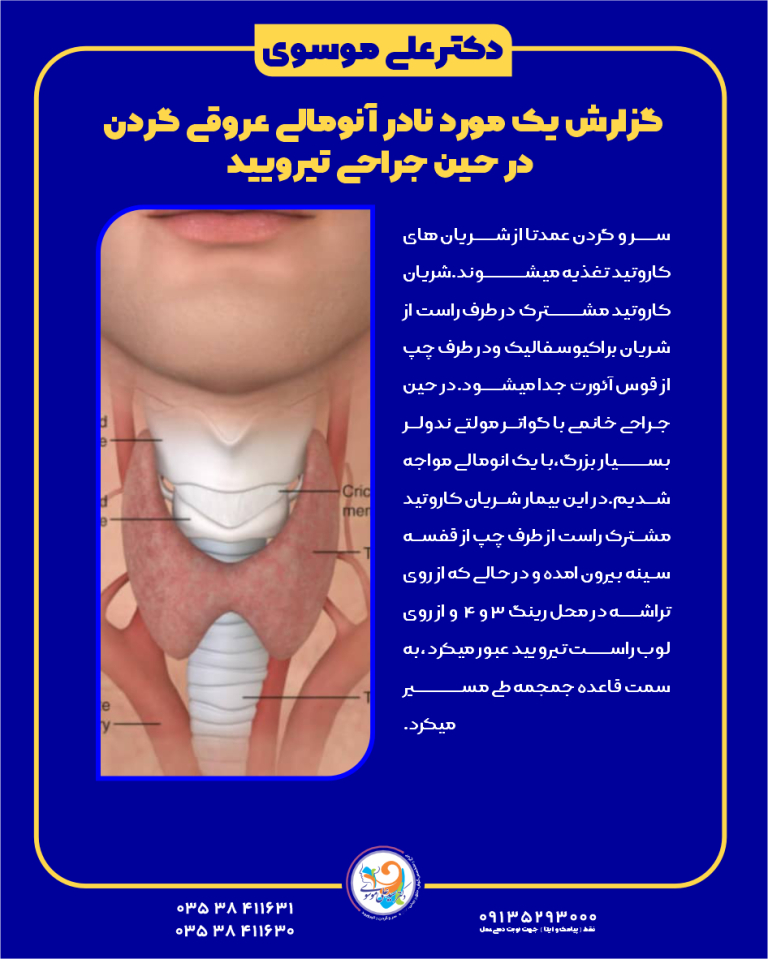 گزارش یک مورد نادر آنومالی عروقی گردن در جراحی تیروئید در یزد 