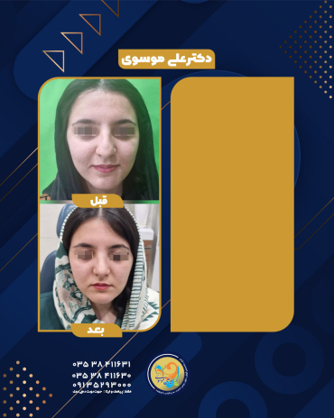 عمل بینی یزد 