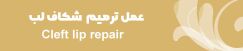 آیکون عمل عمل ترمیم شکاف لب در سایت دکتر سید علی موسوی 