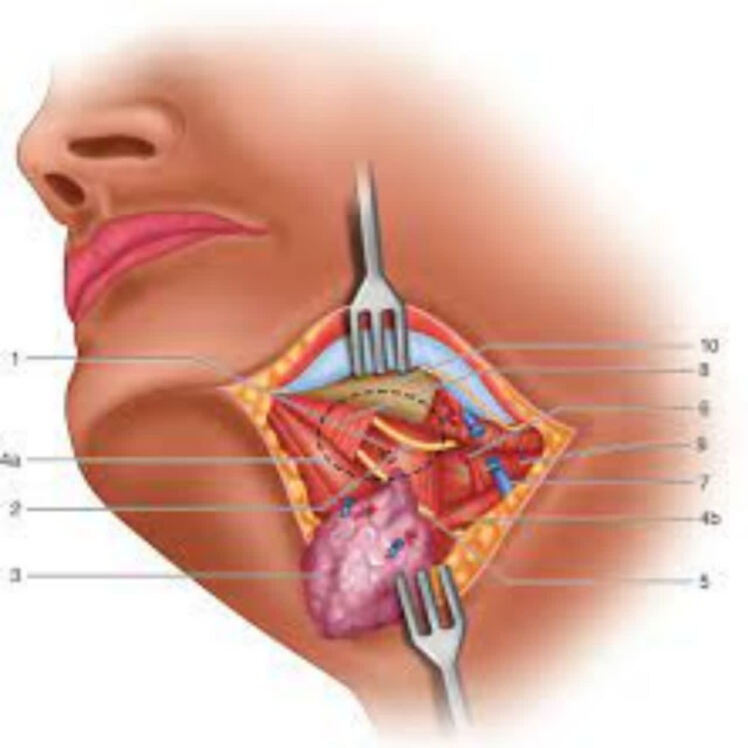راهنمای مراقبتهای قبل و بعد از جراحی سابمکس / مندیبولار (Submandibular / Mandibular Surgery)