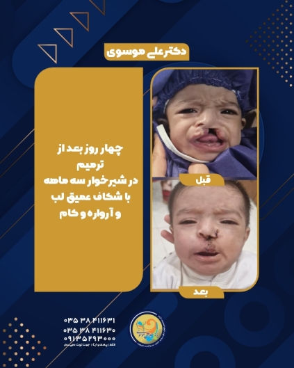 لبخندی که دوباره متولد شد.