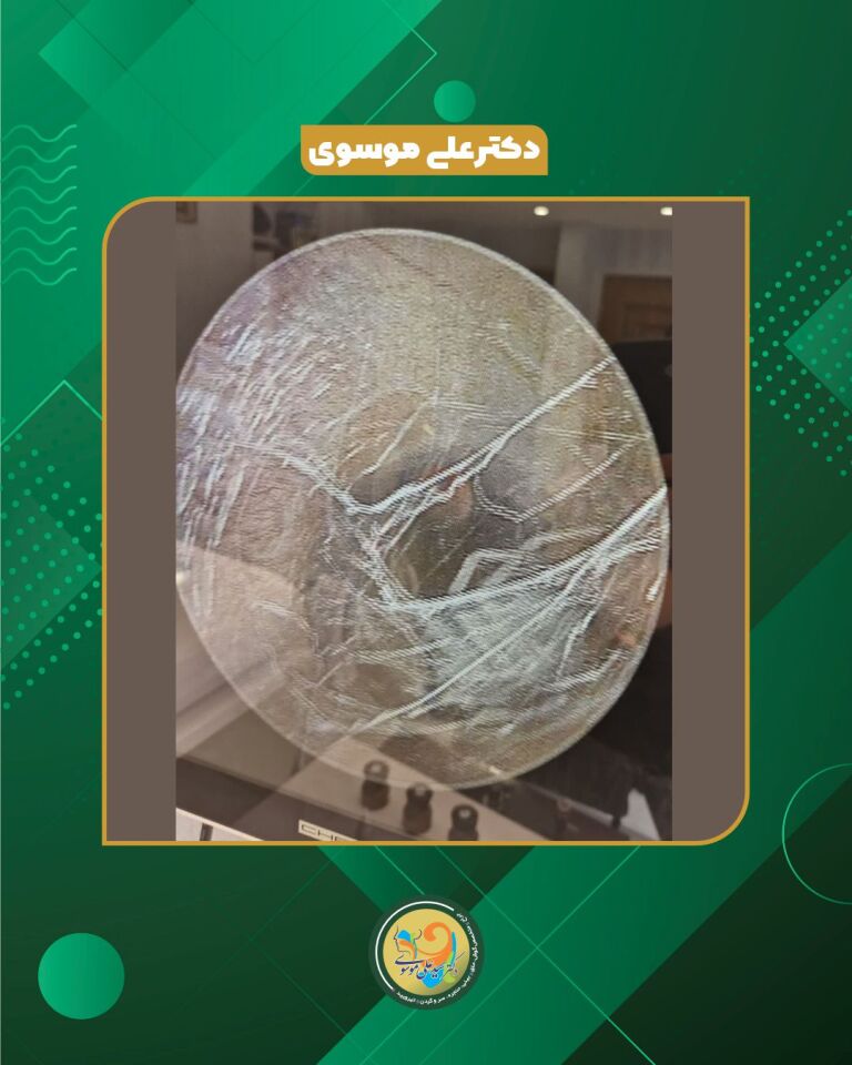 تعهد مطلق؛ وقتی حتی در کانال گوش هم مأموریت فراموش نمی‌شود | دکتر سید علی موسوی یزد 