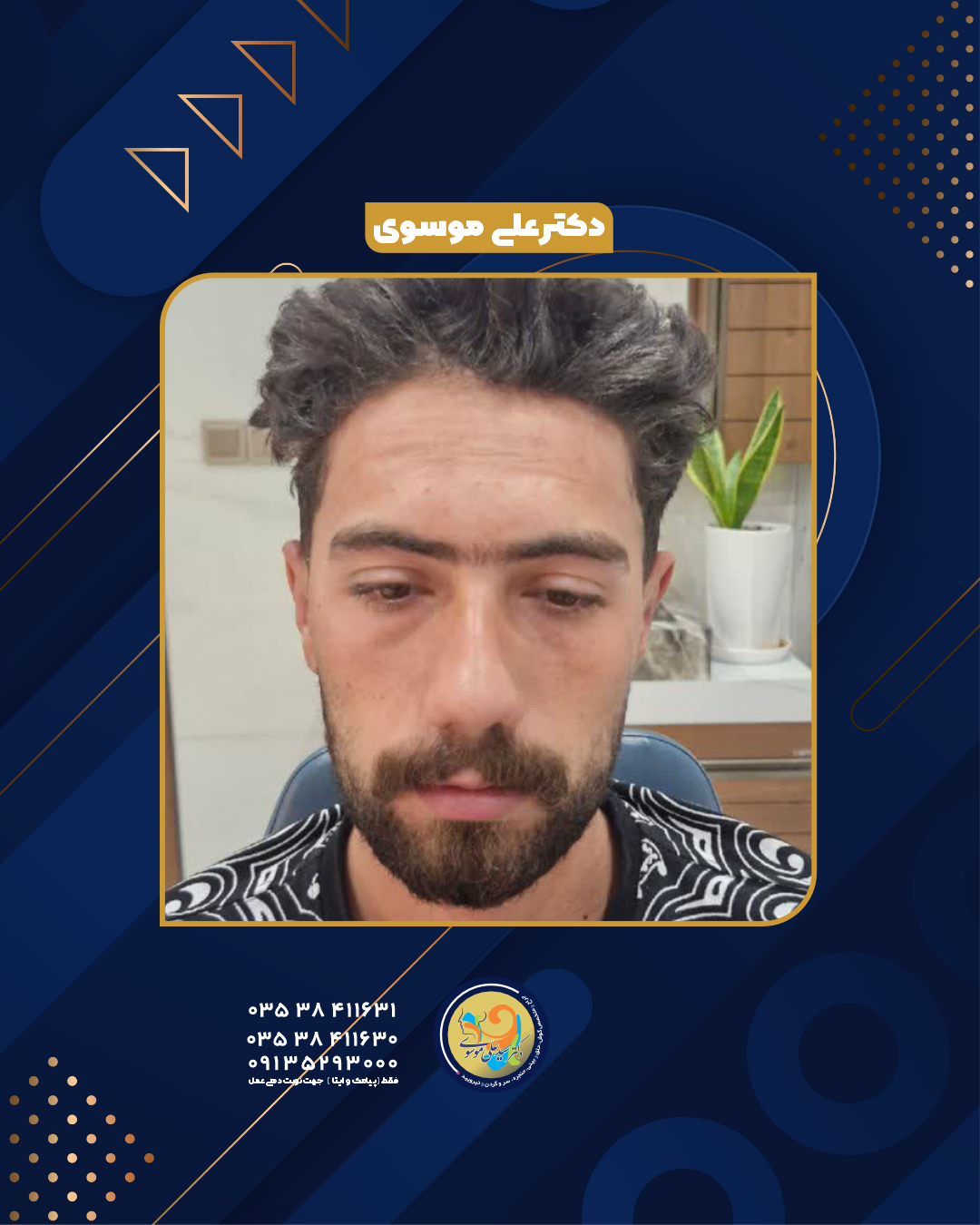 عمل اتوپلاستی