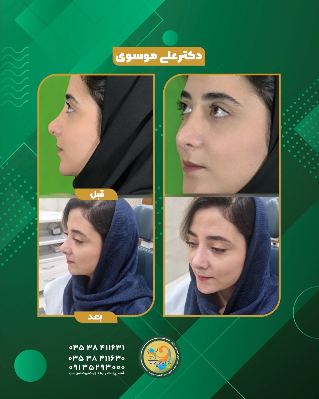 عمل بینی یزد 