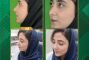 عمل زیبایی بینی در یزد؛ اصلاح همزمان تنفس و فرم بینی در یک جراحی ترمیمی