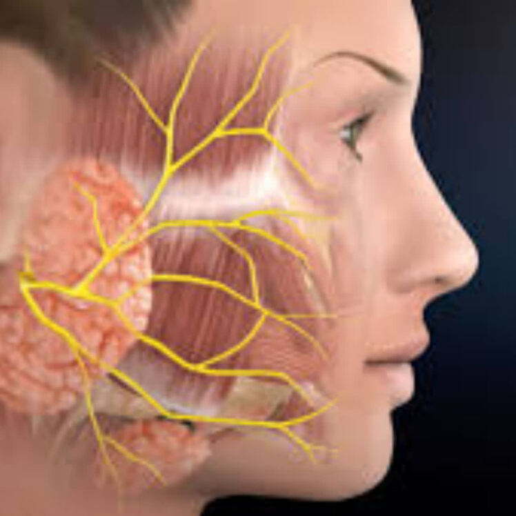راهنمای مراقبتهای قبل و بعد از جراحی پاروتیدکتومی (Parotidectomy)