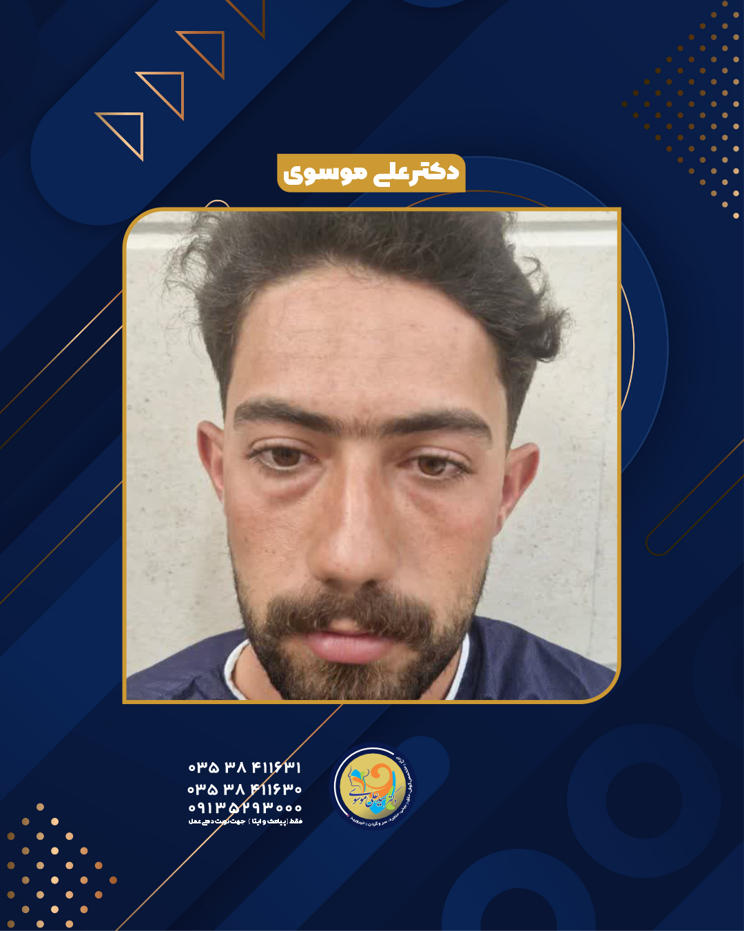 عمل گوش توسط دکتر سید علی موسوی یزد