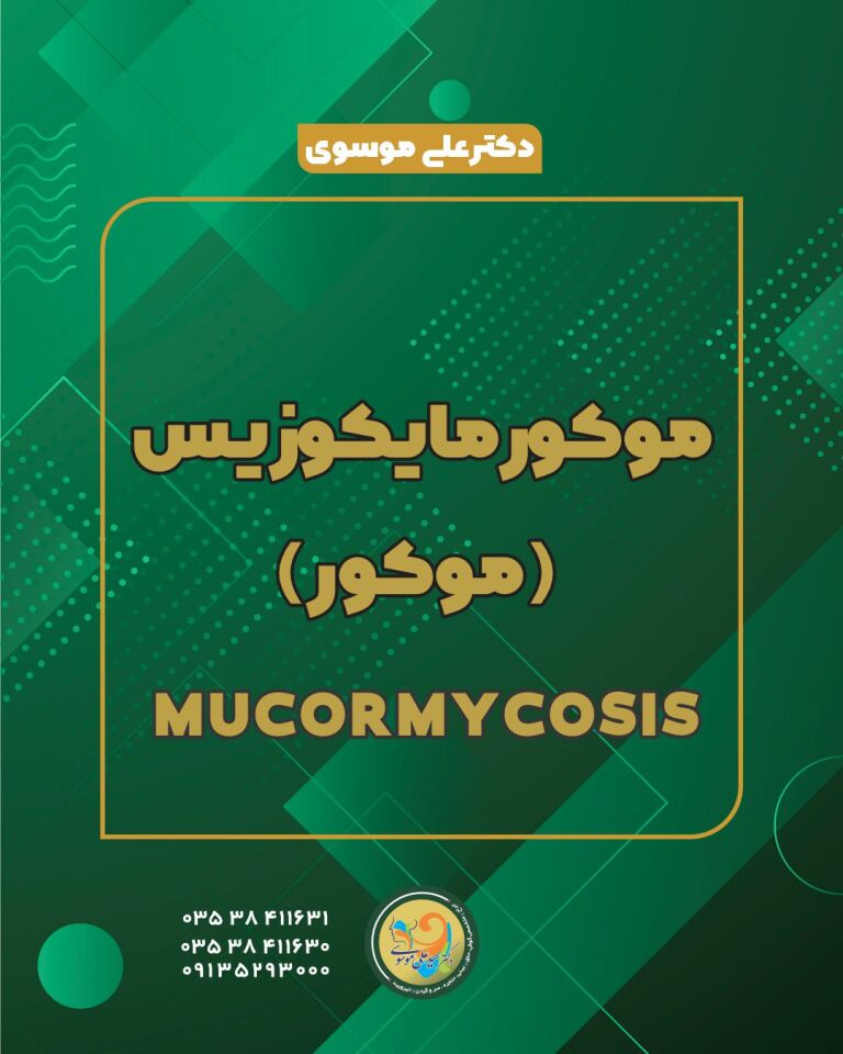 موکورمایکوزیس: عفونت قارچی نادر اما کشنده